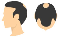 Inhammen